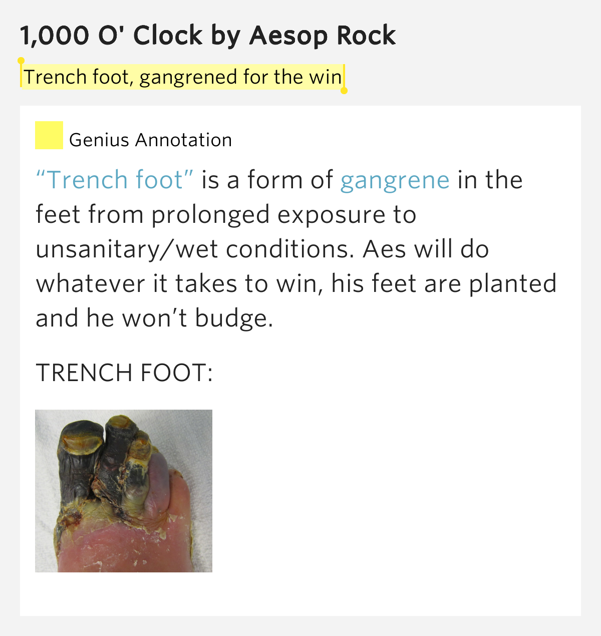 trench-foot-gangrened-for-the-win-1-000-o-clock-by-aesop-rock