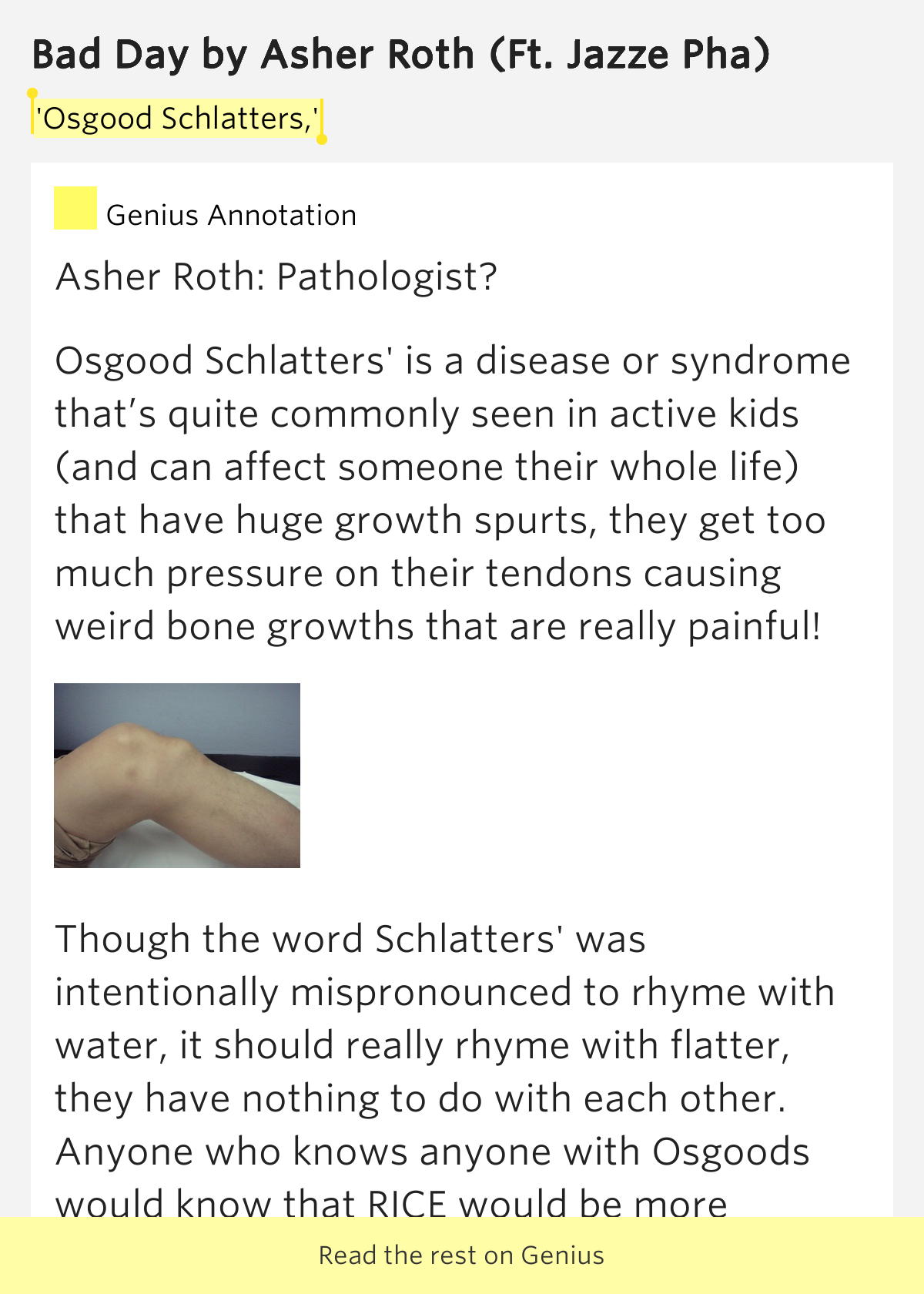 'Osgood Schlatters,' Bad Day by Asher Roth