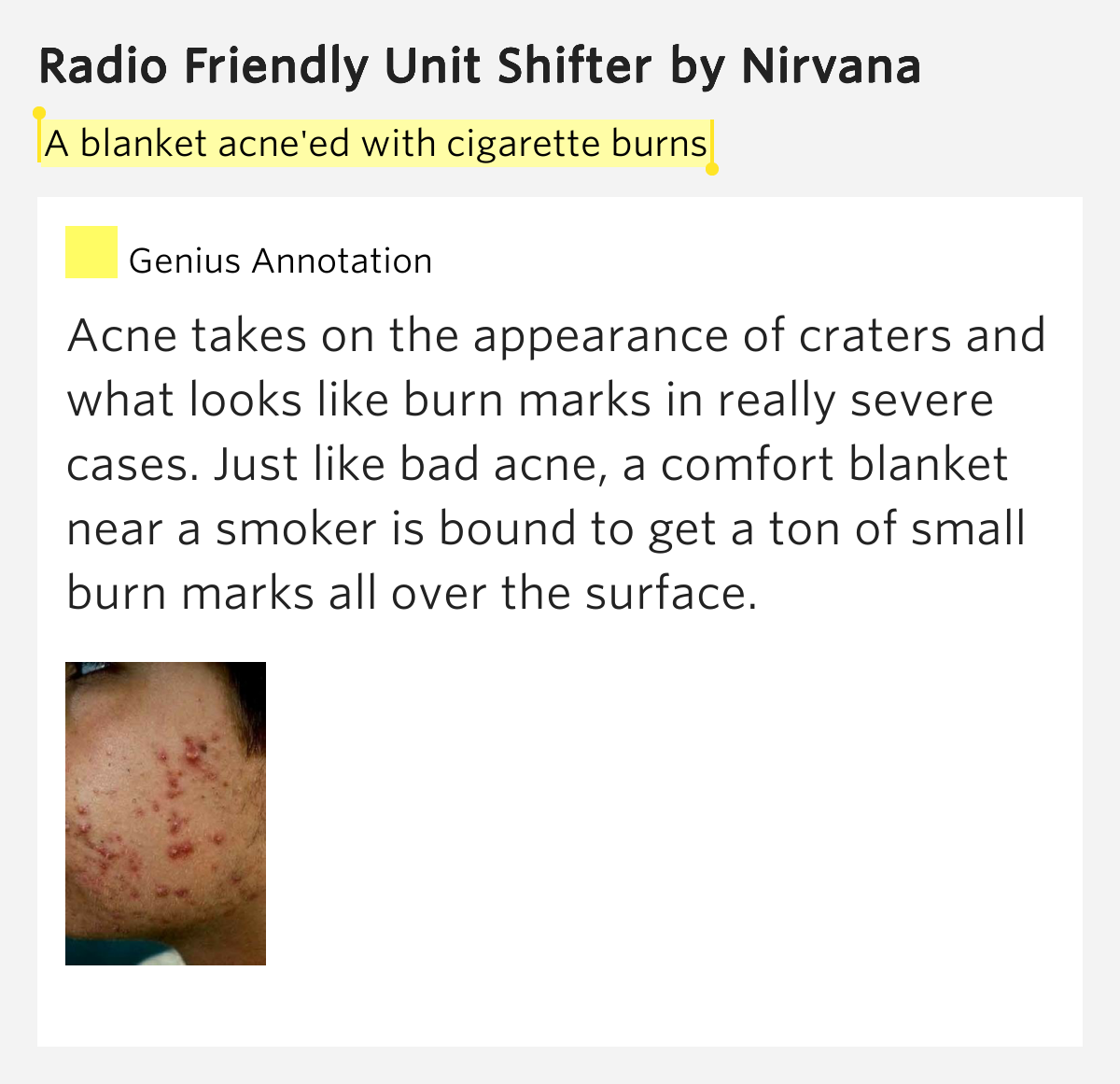 A blanket acne'ed with cigarette.. Radio Friendly Unit Shifter
