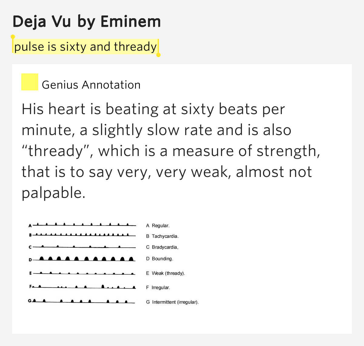 Pulse is sixty and thready Deja Vu by Eminem