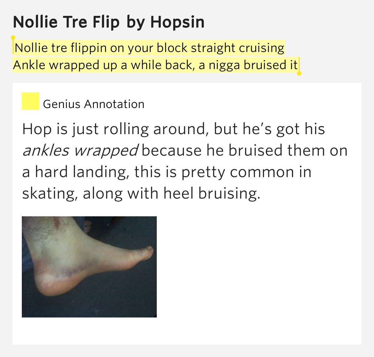 Nollie tre flippin on your block straight cruising / Ankle wrapped up a